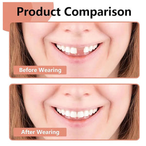 Smile Teeth Fake Braces Lower and Upper Fake Teeth Veneer Silica Gel False Teeth Removable Denture Oral Care Dentistry Veneer