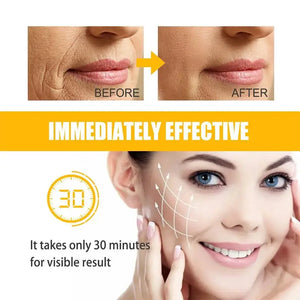 Collagen Smile Line Gel Patch Lifting Firming Relief Sagging Mouth Wrinkle Treatment Anti Aging Tighten Sticker Korean Skin Care