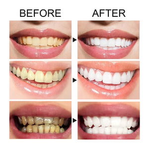 60ml Teeth Whitening Cleaning Mousse Repair Caries Freshens Oral Cleaning Breath Remove Tooth Stain Gingival Dental Care Essence