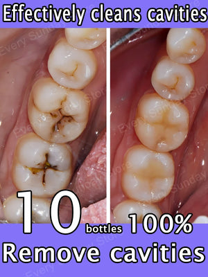 Clean cavities,whiten teeth, remove plaque, treat periodontitis, freshen breath