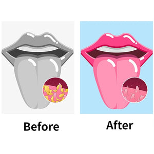 Tongue Scraper and Coating Cleaning Gel Fresh Remove Odor To Cleaner for Bad Breath Cleaning Products for Tongue Cleaning