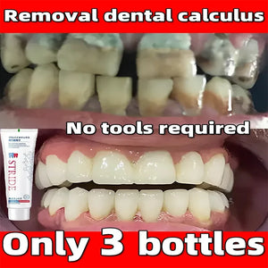 Dental Calculus Remove Whitening Teeth Toothpaste Brightening Preventing Periodontitis Removal Bad Breath Dental Cleansing Care