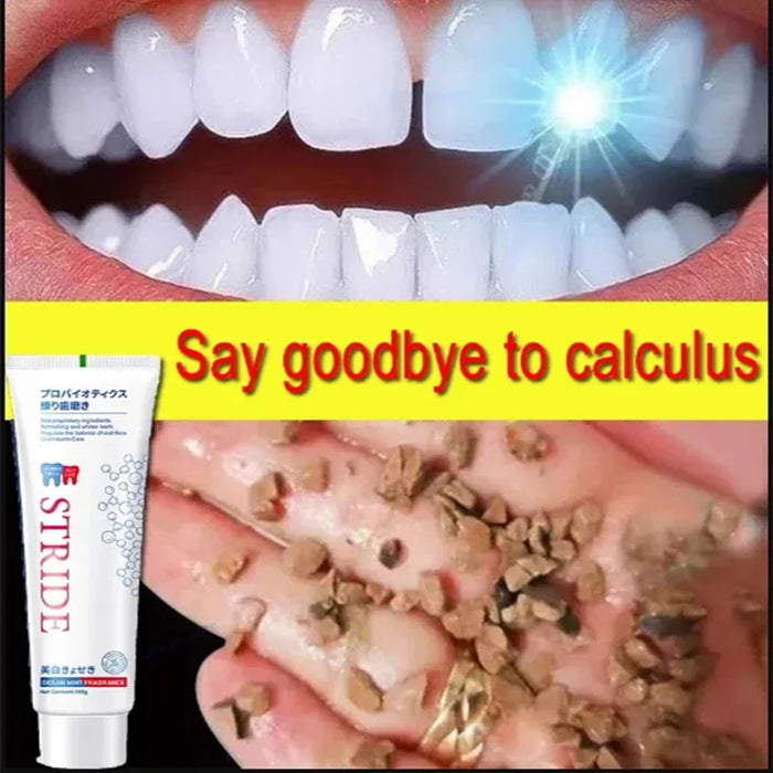 Dental Calculus Remover Teeth Whitening Toothpaste Removal Bad Breath Preventing Periodontitis Dental Brightening Oral Cleaning