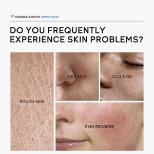 Repair Facial Redness Serum Effective Soothing Sensitive Skin Fast Treatment Redness Rosacea Itching Moisturizer Korean Cosmetic