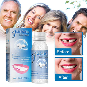 30ML Temporary Filling Tooth Repair Granules Teeth Gaps Missing Broken Tooth False Teeth Filling Moldable Solid Glue Dental Care