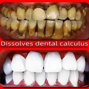 Whitening Probiotics Toothpaste Enzyme Dental Stone Remover Oral Odor Prevention Toothpaste Periodontitis Freshens Breath 2024