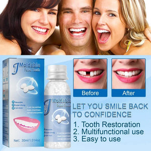 30ml Resin Temporary Tooth Repair Granules Teeth Gaps Missing Broken Tooth False Teeth Filling Moldable Solid Glue Dental Care