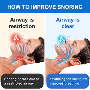 Adjustable Anti-Snoring Mouth Guard, Anti-Snoring Device, Prevents Teeth Grinding During Sleep and Improves Men Sleep Quality