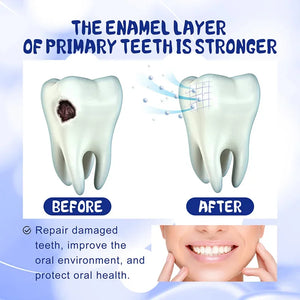30g Anti Decay Toothpaste Dental Caries Repair Cream Prevent Tooth Decay Removing Dental Calculus Protect Teeth Freshens Breath