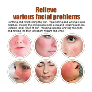 Facial Redness Treatment Cream Instant Rosacea Red Blood Repair Pruducts Anti Redness Spider Vein Sensitive Skin Barrier Care