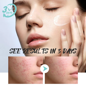 7 Day Face Rosacea Treatment Cream Collagen Intense Repair Redness Dry Sensitive Itching Skin Moisturize Sooth Korean Cosmetics