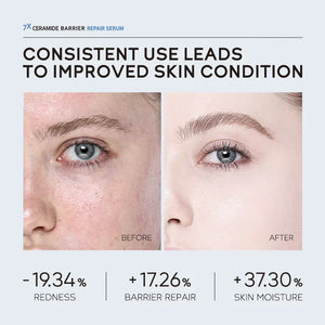 LAIKOU 7X CERAMIDE Facial Serum Rosacea Red Blood Vein Treatment Improve Sensitive Repair Moisturizing Serum Korean Cosmetics