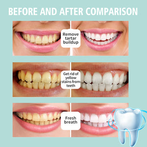 Teeth Cleansing Mousse Remove Plaque Stains Breath Freshen Dental Gingival Repair Caries Oral Hygiene Foam Whitening Toothpaste