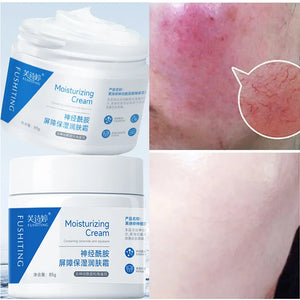 Facial Redness Treatment Cream Instant Rosacea Red Blood Repair Pruducts Anti Redness Spider Vein Sensitive Skin Barrier Care