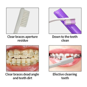 8pcs/set Oral Cleaning Care Orthodontic Teeth Whitening Tools Ortho Toothbrush Interdental Brush Dental Floss Thread Travel Kit