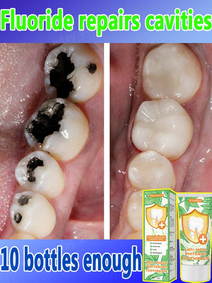 Best-selling, scientific fluoride repairs cavities, removes cavities, cleans plaque, whitens teeth, and freshens breath