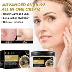 Snail Face Cream Anti Redness Pimple Removal Shrink Pores Repair Sensitive Skin Replenishing Moisturizer Acne Treatment Cream