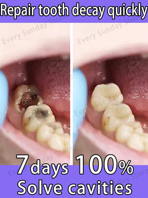Clean cavities,whiten teeth, remove plaque, treat periodontitis, freshen breath