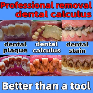 Whitening Probiotics Toothpaste Enzyme Dental Stone Remover Oral Odor Prevention Toothpaste Periodontitis Freshens Breath 2024
