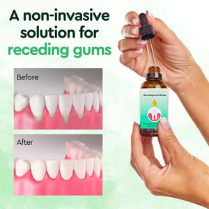 Gum Repair Drops Relieve Receding Gingival Swelling Gum Cleaning Care Oral Periodontal Hygiene Remove Stain Remove Yellow Tartar