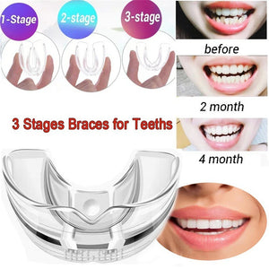 3 Stages Silicone Tooth Invisible Orthodontic Set Dental Appliance Teeth Retainer Mouth Guard Braces Tooth Tray Tooth Care Tool