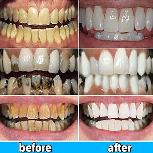 Whitening Probiotics Toothpaste Enzyme Dental Stone Remover Oral Odor Prevention Toothpaste Periodontitis Freshens Breath 2024