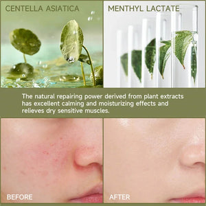 Facial Redness Treatment Cream Instant Rosacea Red Blood Repair Pruducts Anti Redness Spider Vein Sensitive Skin Barrier Care