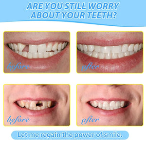 Temporary Tooth Repair Glue Shapeable Teeth Gaps Filling Solid Denture Hot Melt Adhesive Mouth Safety Dental Supplies Oral Care