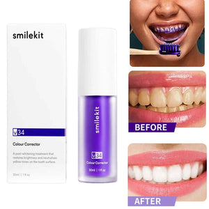 V34 Smilekit Whitening Toothpaste Remove Stains To Reduce Yellowing Of Teeth Take Care Of Your Gums And Freshen Your Breath