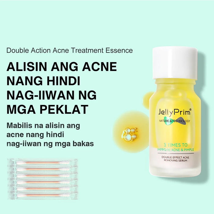 Salicylic Acid Acne Face Serum Niacinamide Pimple Scaring Marks Remove Oil Control Sensitive Skin Facial Serum Gentle Skincare