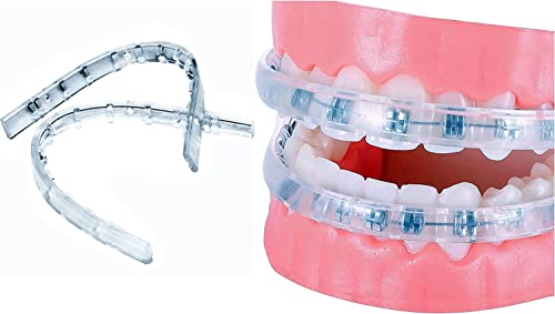 Clip-on Comfort Covers for Braces, Orthodontic Mouth Guard for Braces, Lip Protector, Wax Alternative, Lip Bumper for Braces, Lip Shield for Brackets, Braces Accessories