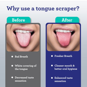 GuruNanda Stainless Steel Tongue Scraper (Pack of 2) with Travel Case, Medical Grade 100% Stainless Steel, Aids in Fresh Breath & Overall Oral Care - Travel Friendly Tongue Scraper For Adults and Kids