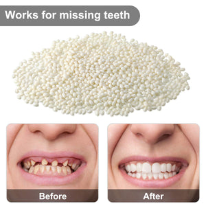 100g Bead Teeth Tooth Solid Gel Temporary Moldable Thermal Fitting Bead Teeth Pellet Fake Teeth Filler for Halloween Scary Themed Party Makeup Fix The Missing Broken Tooth, White